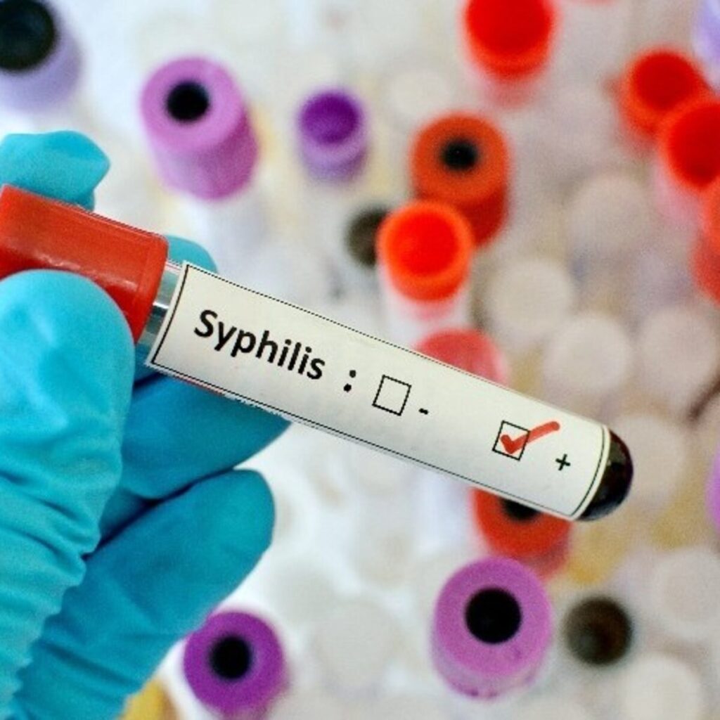 Cipolletti: fuerte incremento de sífilis pone en alerta al sistema de salud