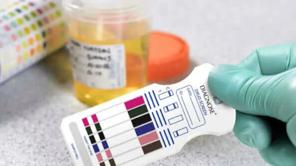 El gobierno puso en marcha los controles toxicológicos para cargos públicos